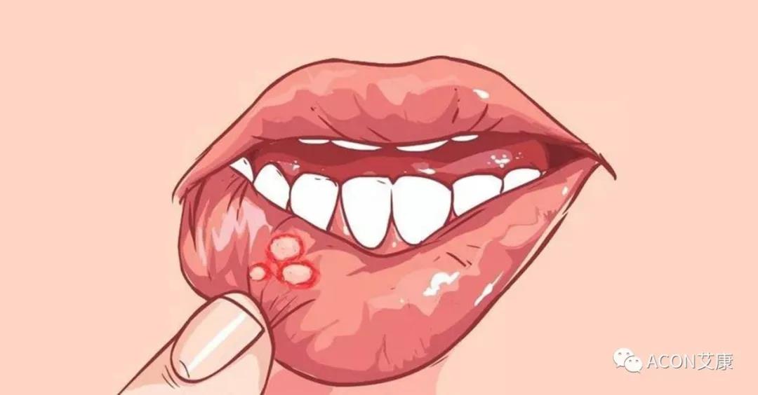 哪些小病容易讓人忽視，最后造成越拖越嚴(yán)重呢？