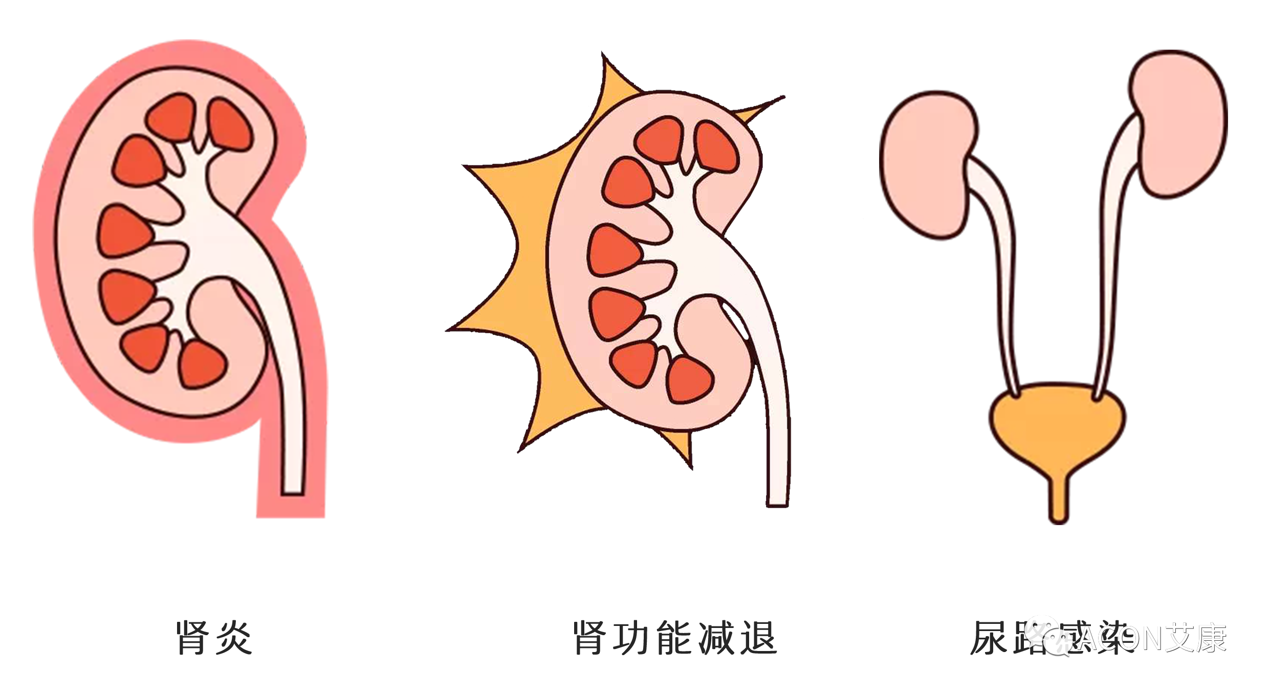 排尿黃、異味大，可能是身體在報警！