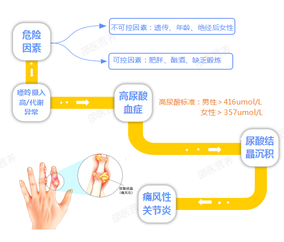 痛風(fēng)為什么偏愛男性？你最關(guān)心的問題都在這里