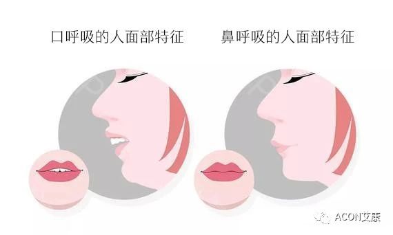 過敏性鼻炎會讓孩子變傻？！家長該如何應(yīng)對